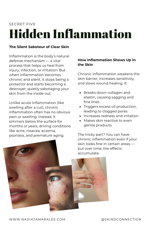 Clear Skin From Within eBook