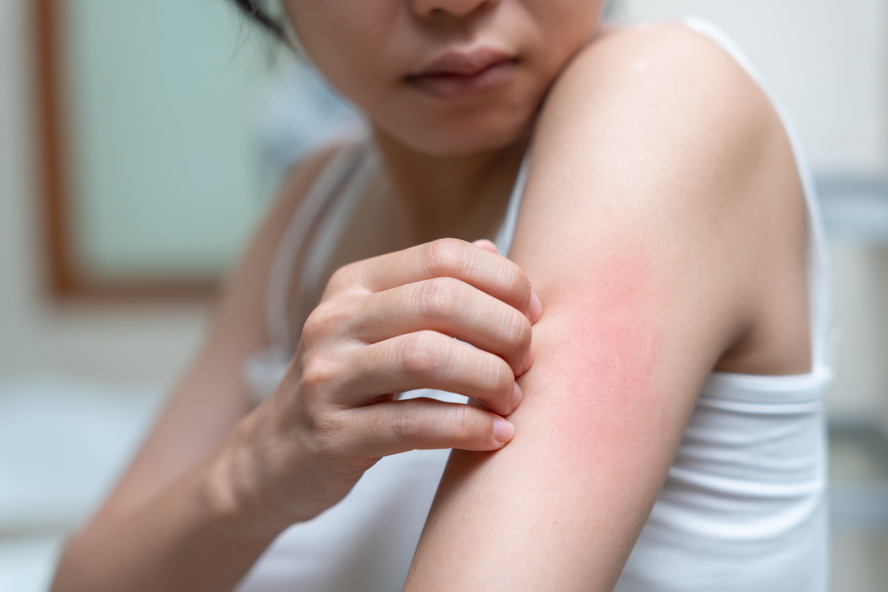 The Calm Skin Protocol | Certification in Sensitive & Inflammatory Skin