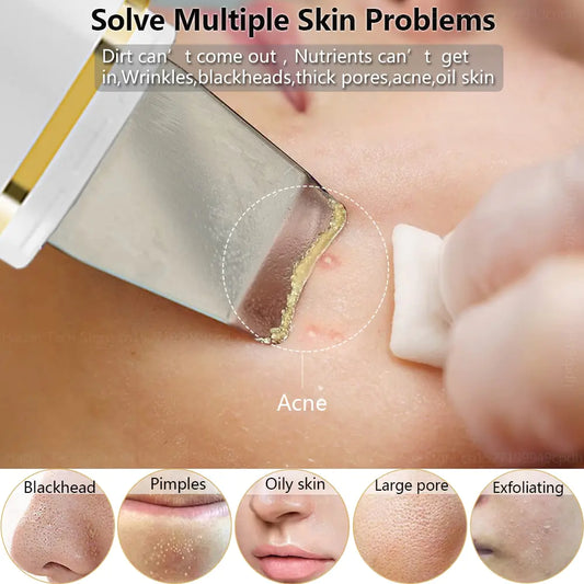 Facial Cleansing Ultrasonic Skin Scrubber
