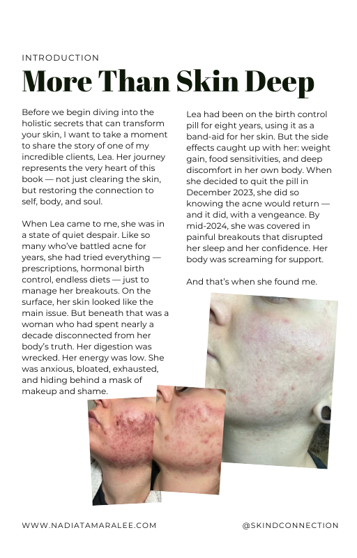 Clear Skin From Within eBook
