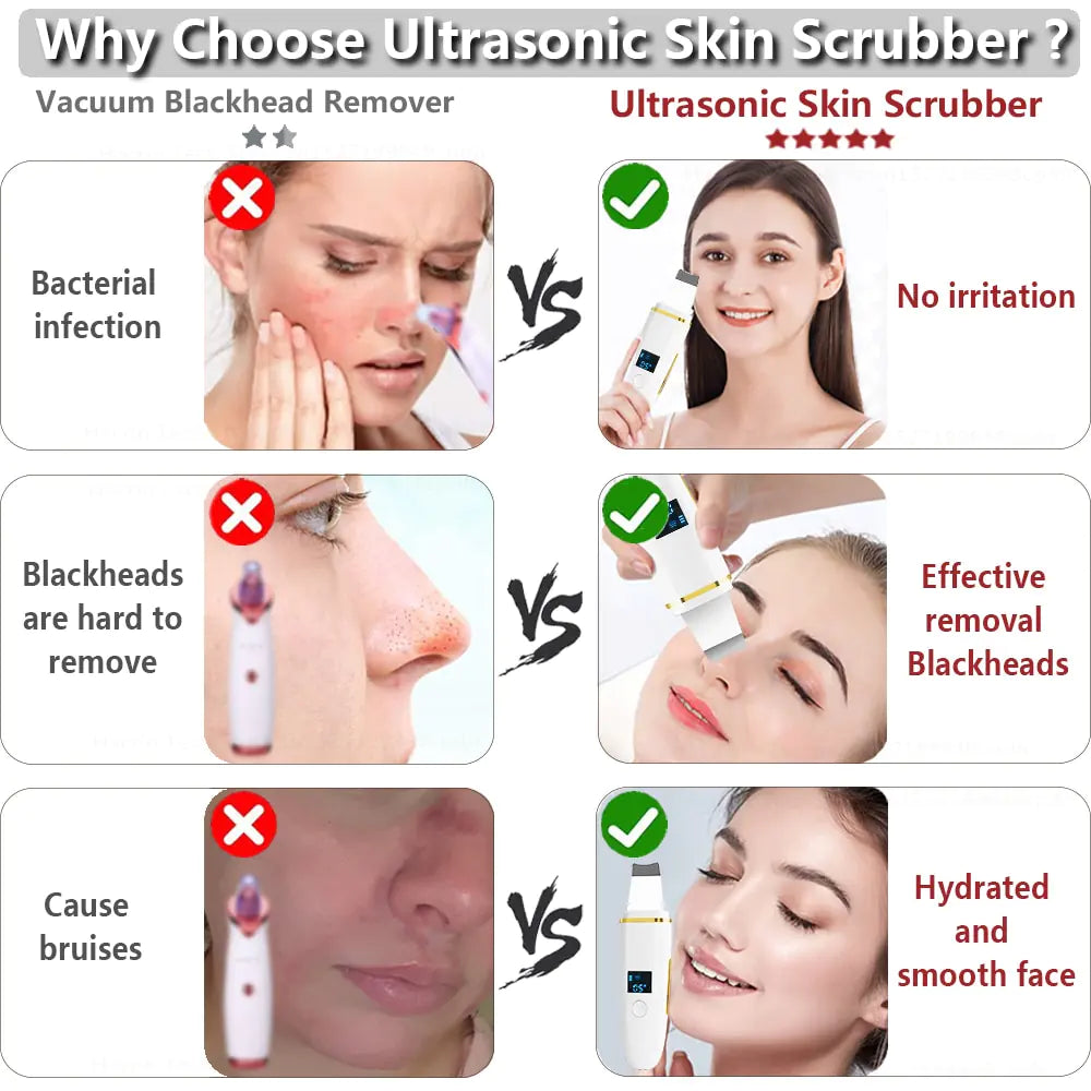 Facial Cleansing Ultrasonic Skin Scrubber
