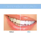 Teeth Whitening Device for Brightening and Cleaning