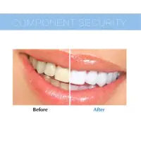 Teeth Whitening Device for Brightening and Cleaning