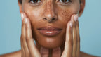 The Even Tone Strategy | Advanced Certification in Pigmentation Healing