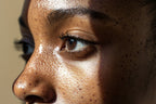 The Even Tone Strategy | Advanced Certification in Pigmentation Healing